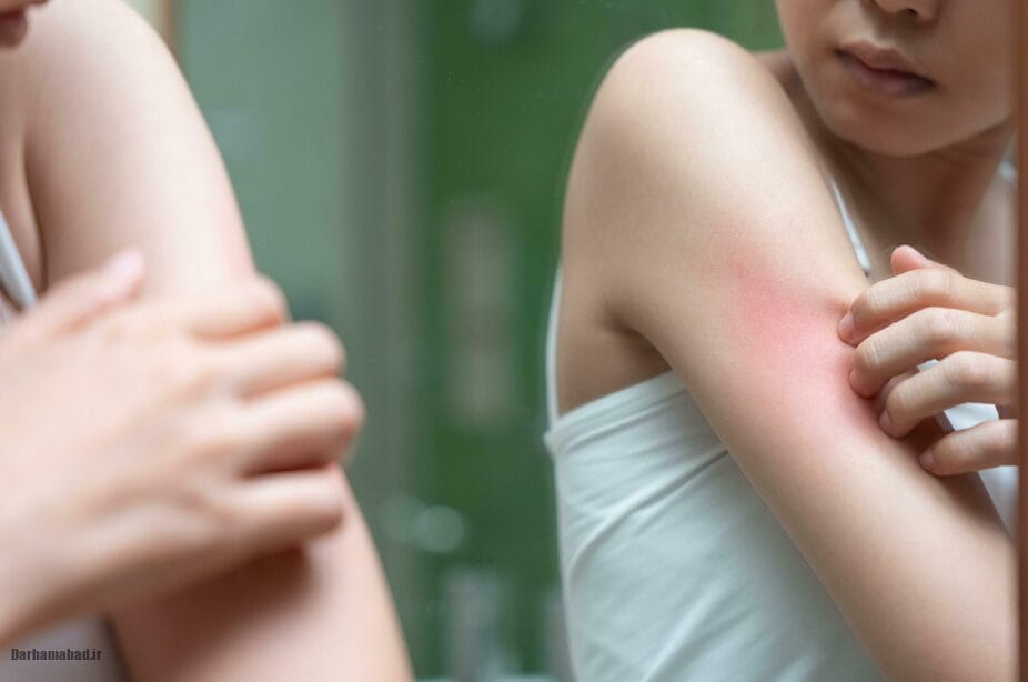 دلایل تعریق شبانه چه مواردی است؟