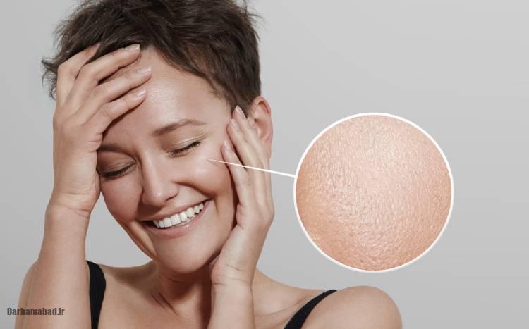 راهنمای کامل روتین پوست چرب و برطرف کردن آن