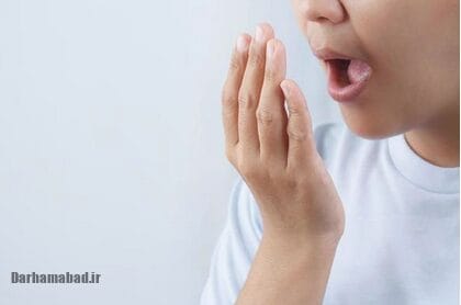 بوی بد دهان