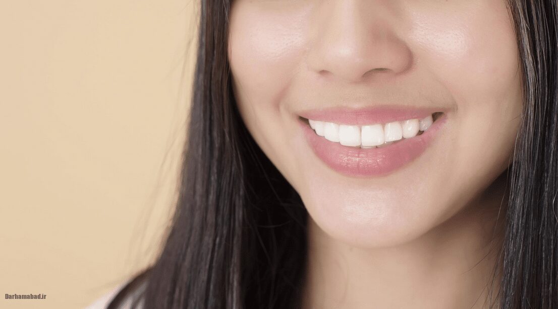 دندان سفید