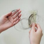 درمان خانگی ریزش مو