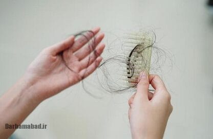 درمان خانگی ریزش مو