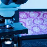 ردیابی تغییرات متابولیکی در تومورها با دستگاه_های پیشرفته