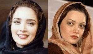 عمل زیبایی بهنوش طباطبایی عمل زیبایی بهنوش طباطبایی