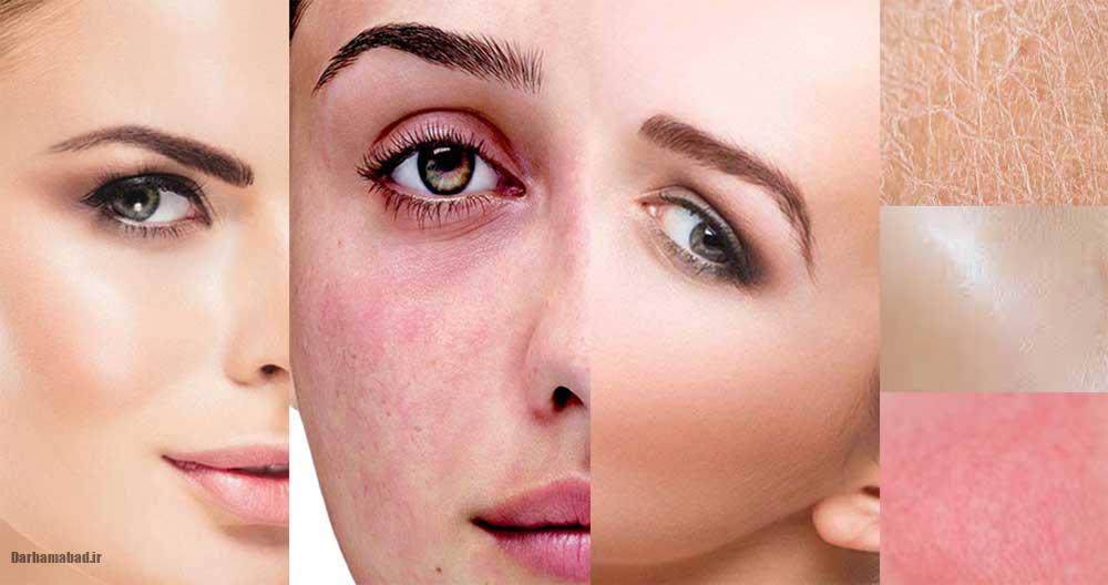 آرایش بدون حساسیت