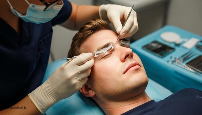 میکروکاشت مو، ابرو و ریش مردانه