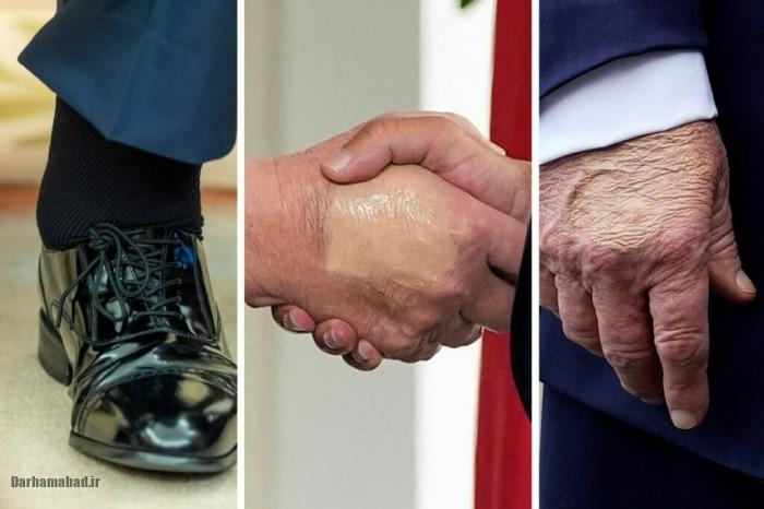 بیماری دونالد ترامپ