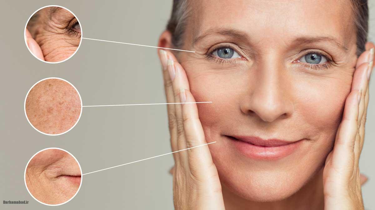 رتینوئید پوست حساس