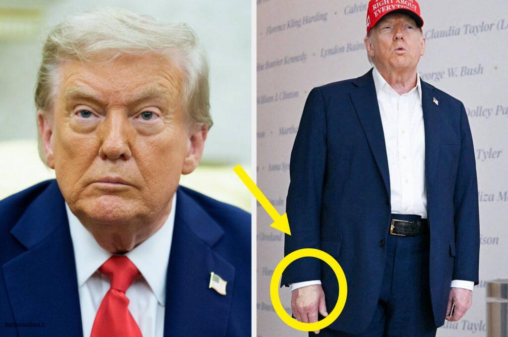 مریضی دونالد ترامپ رئیسجمهور آمریکا چیست؟ مریضی دونالد ترامپ رئیسجمهور آمریکا چیست؟