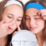 مراقبت از پوست نوجوانان