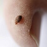 ساس تختخواب