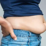 رفع چربی شکم