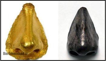 وقتی پیامبر خدا حتی روش درست «پروتز بینی» را هم آموزش می‌دادند!