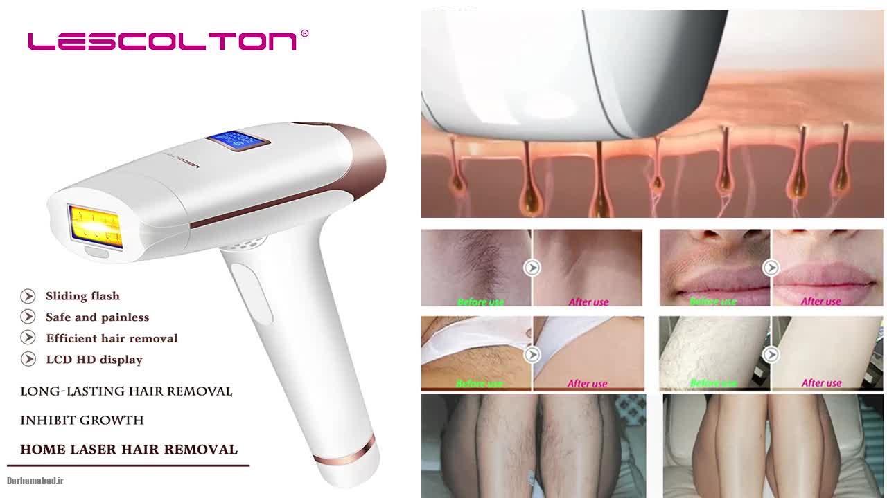 دستگاه لیزر موهای زائد خانگی
