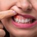 سلامت لثه‌ها