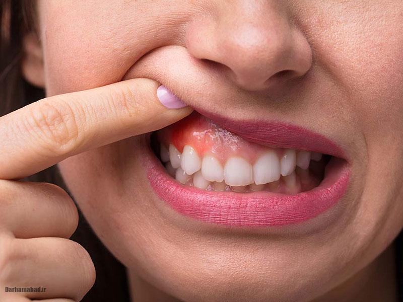 سلامت لثهها