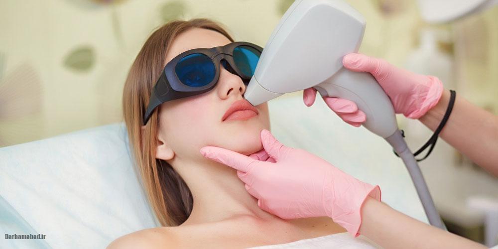 لیزر مو لیزر مو