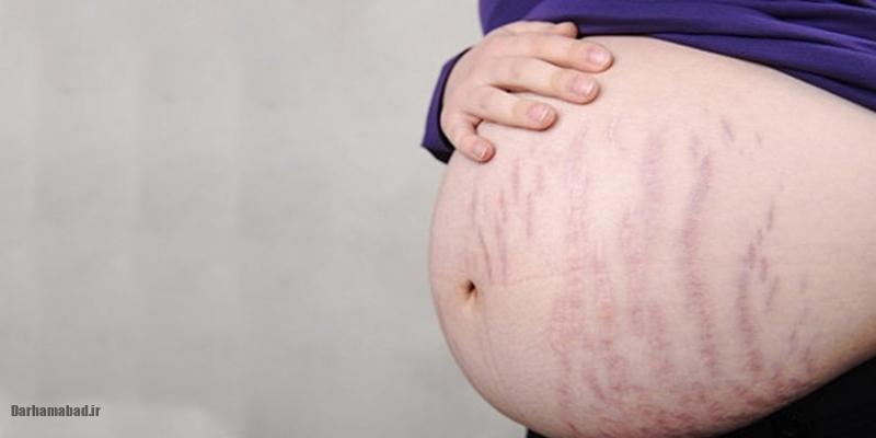 ترکهای بارداری