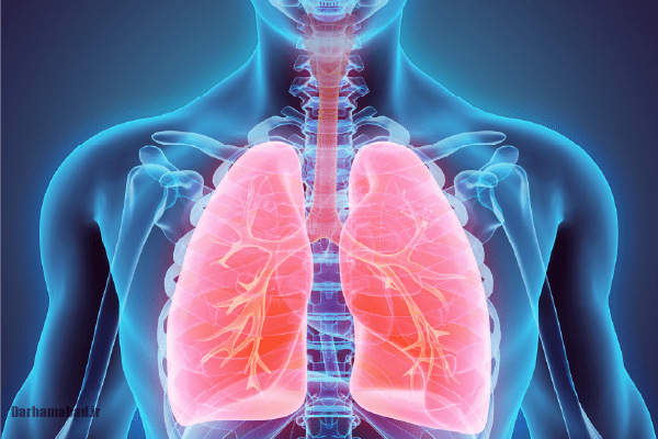 آمبولی ریه آمبولی ریه