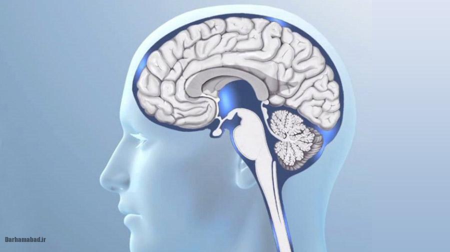 نشت CSF چیست؟