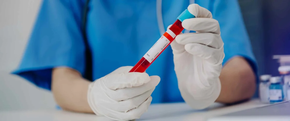 کاهش چربی خون