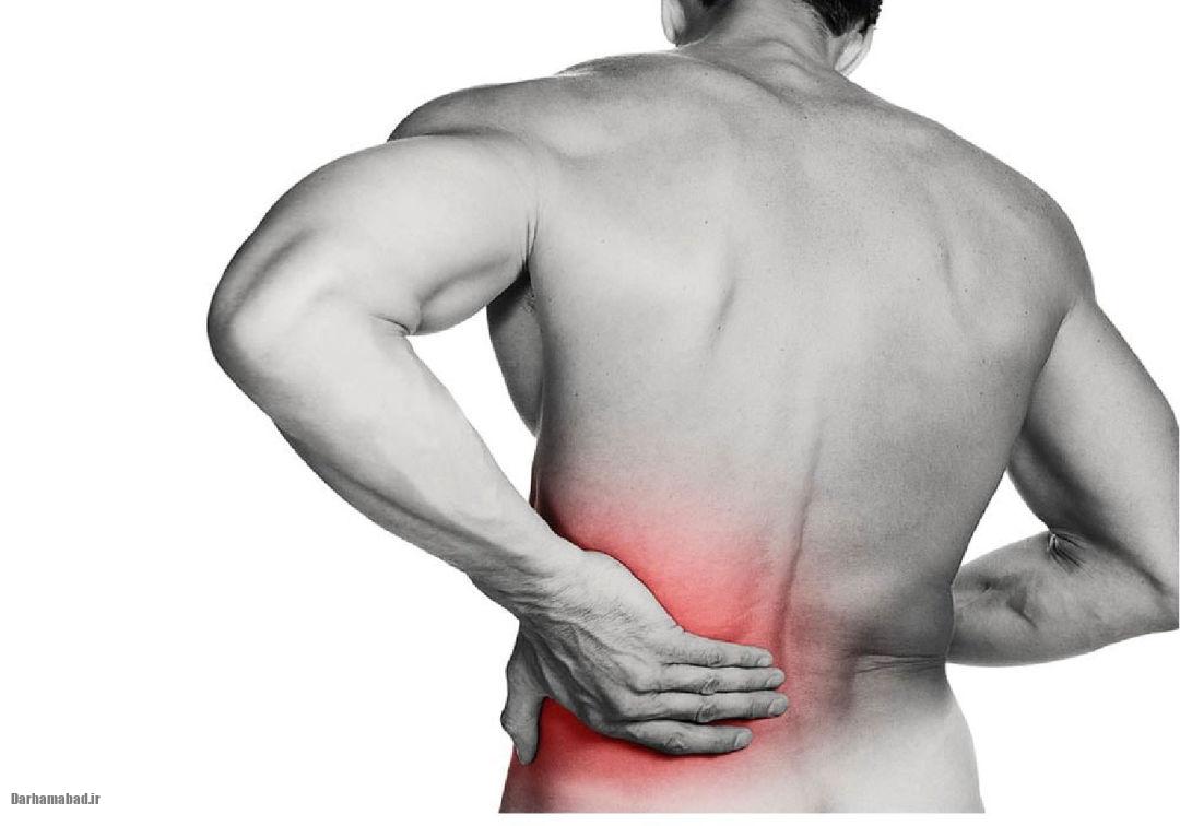 اسپوندیلیت آنکیلوزان اسپوندیلیت آنکیلوزان