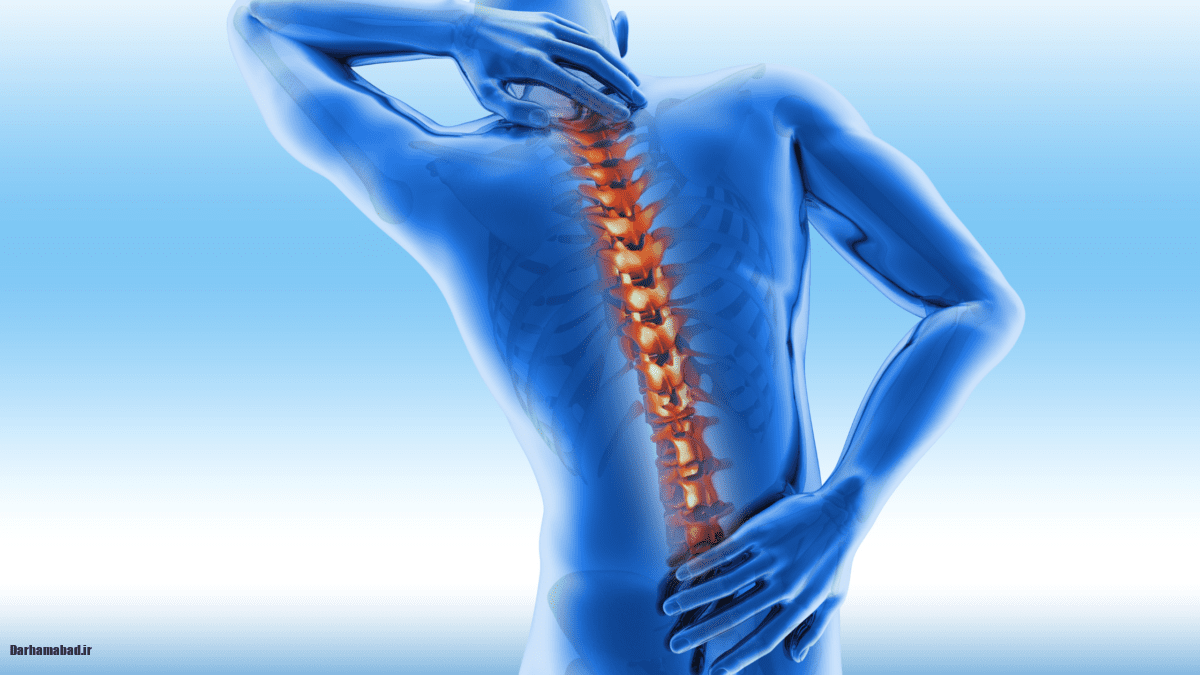 اسپوندیلیت آنکیلوزان