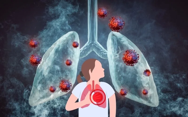 برونشیت چیست؟