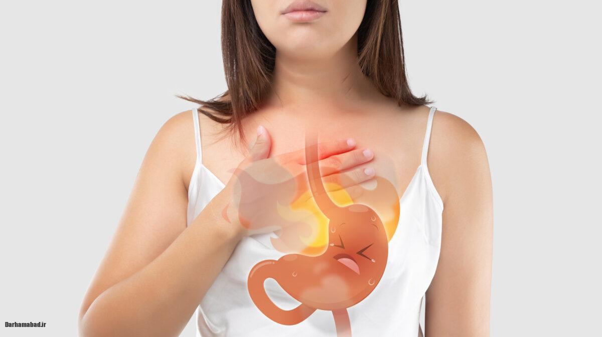 رفلاکس معده (2)