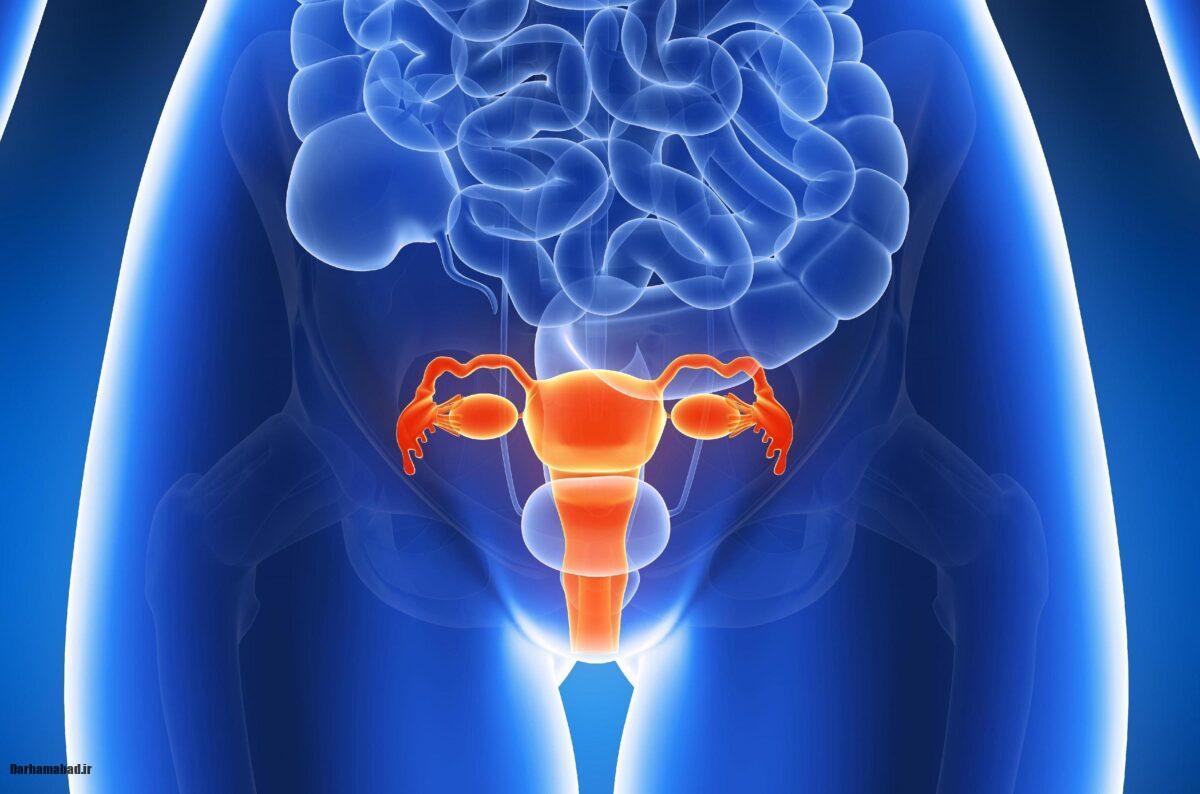 سرطان رحم چیست؟ (3)