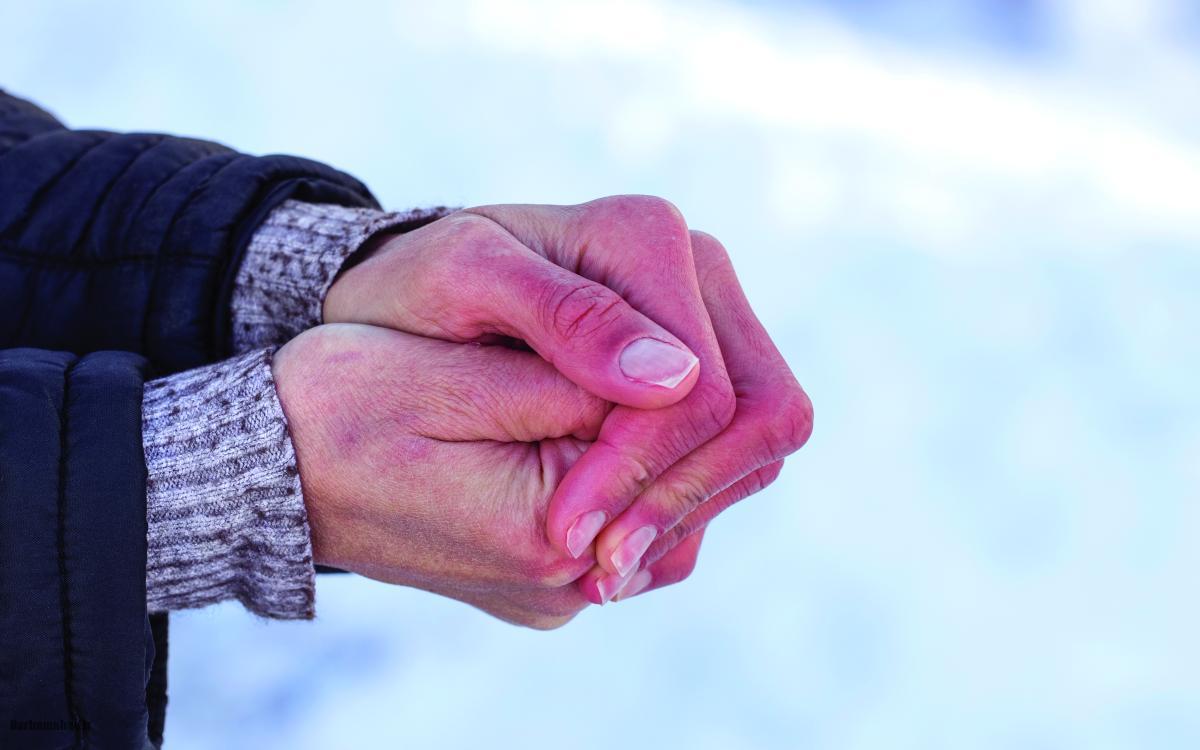 سرمازدگی چیست