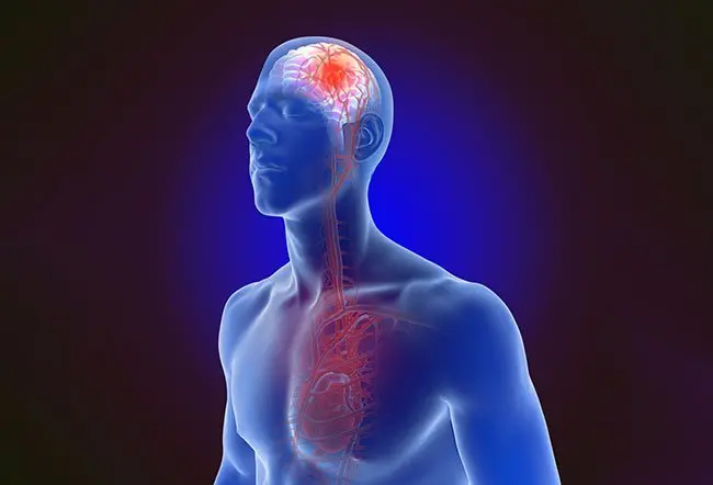 علائم حمله ایسکمی گذرا