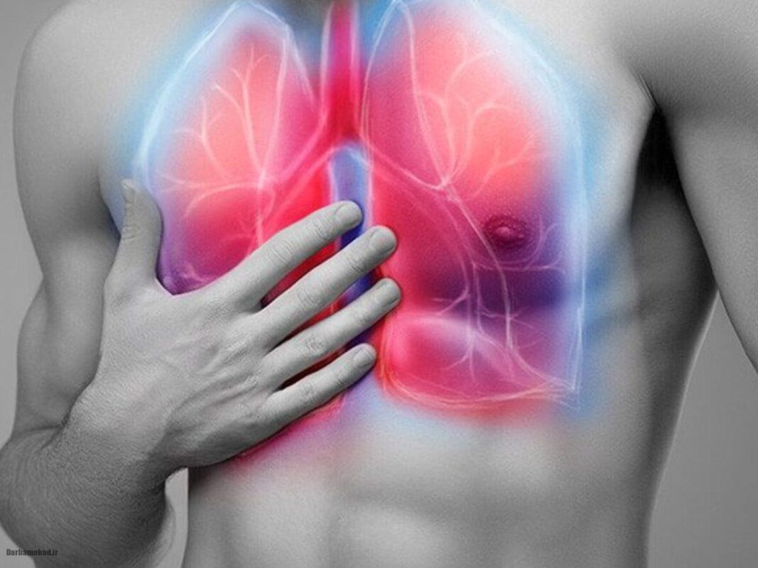 نارسایی حاد تنفسی چیست؟